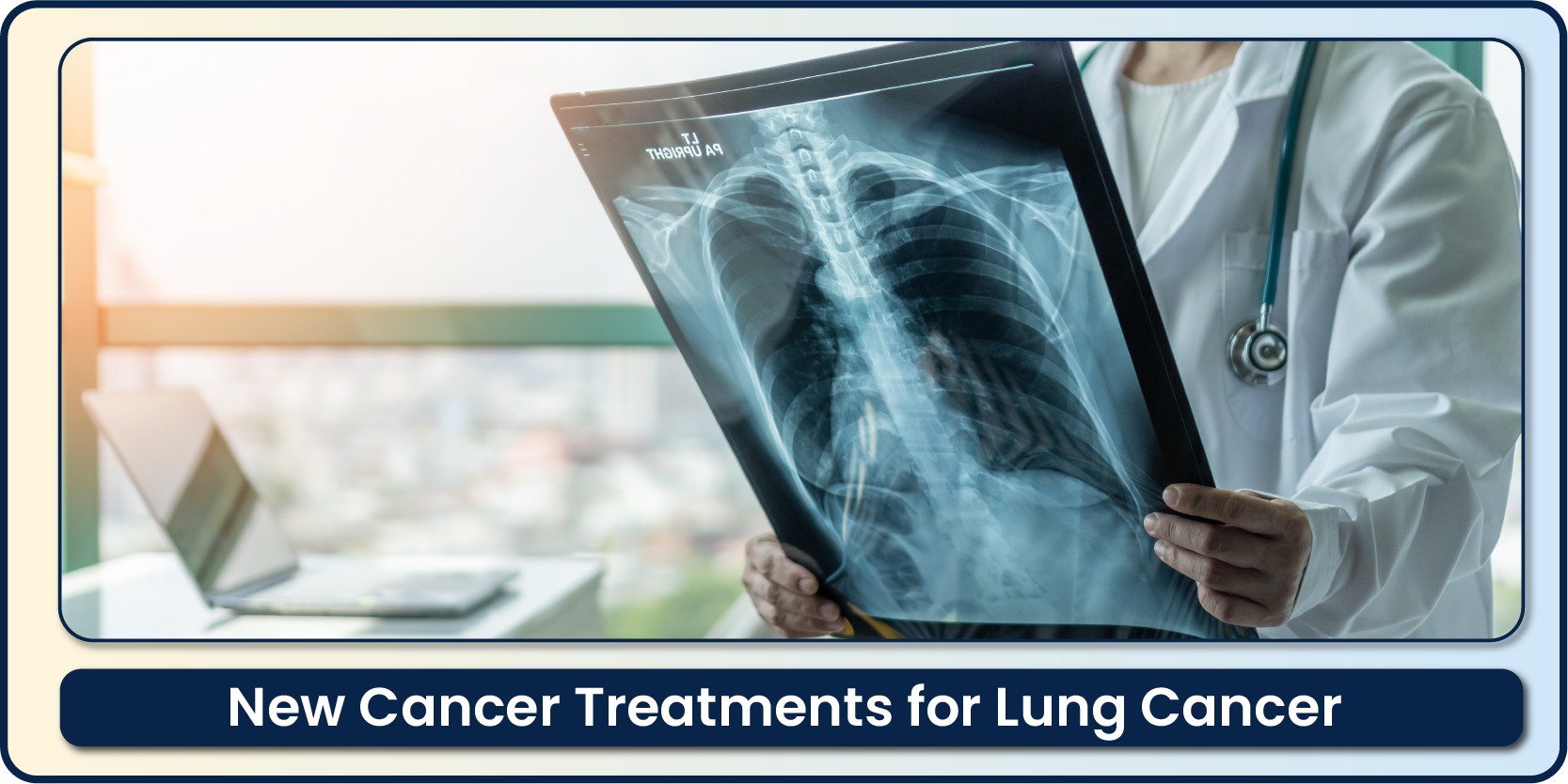 Lung cancer treatment in Bangalore