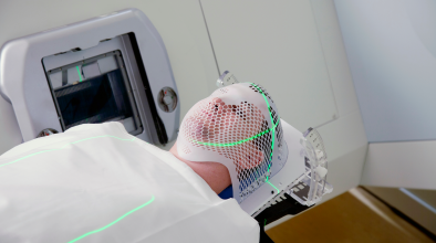 Radiation Therapy treatment in Bangalore