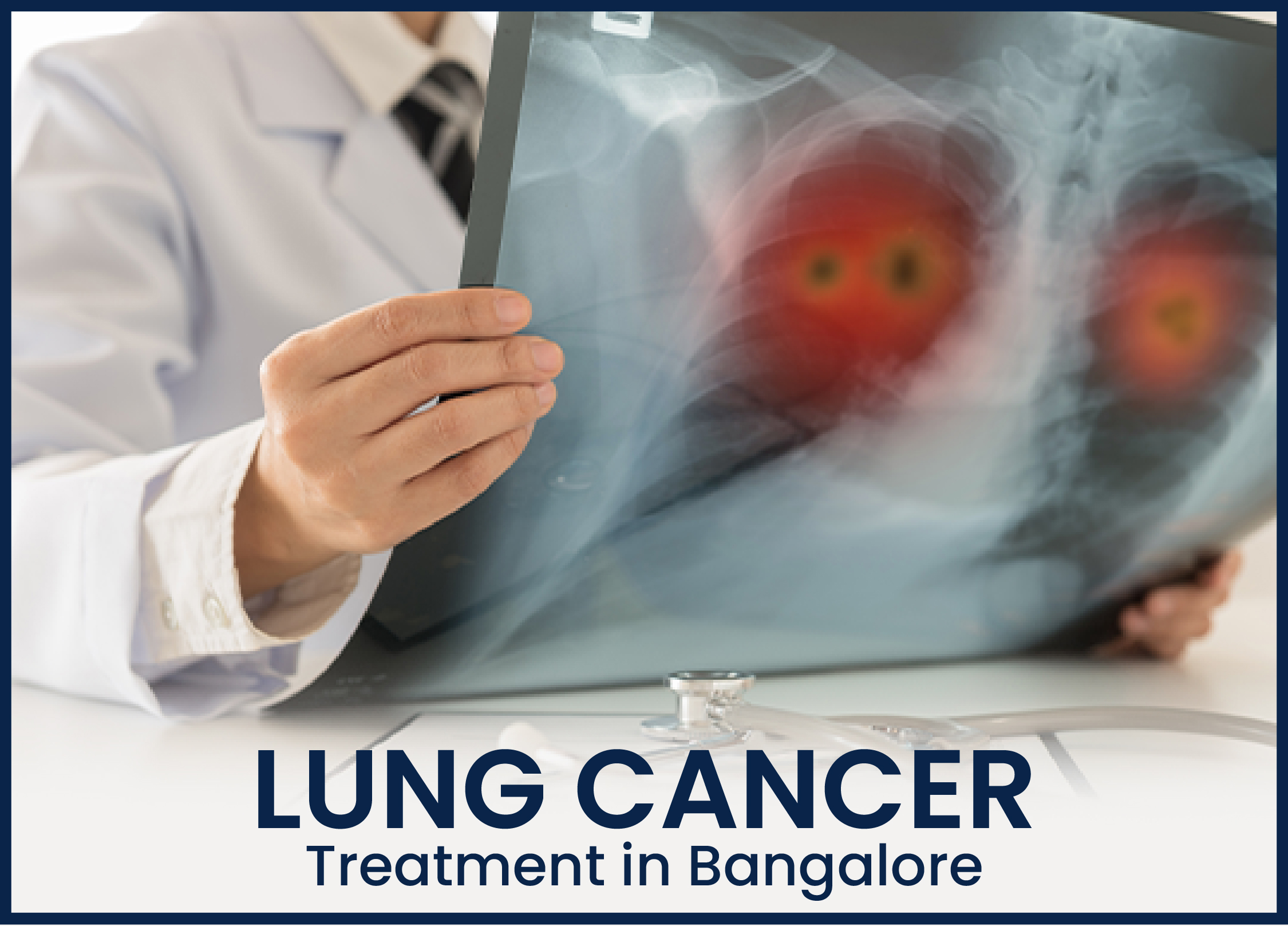 Lung Cancer Treatment in Bangalore